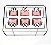 RC